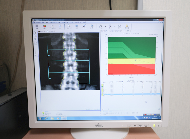 CLEVIEW医用画像ワークステーション